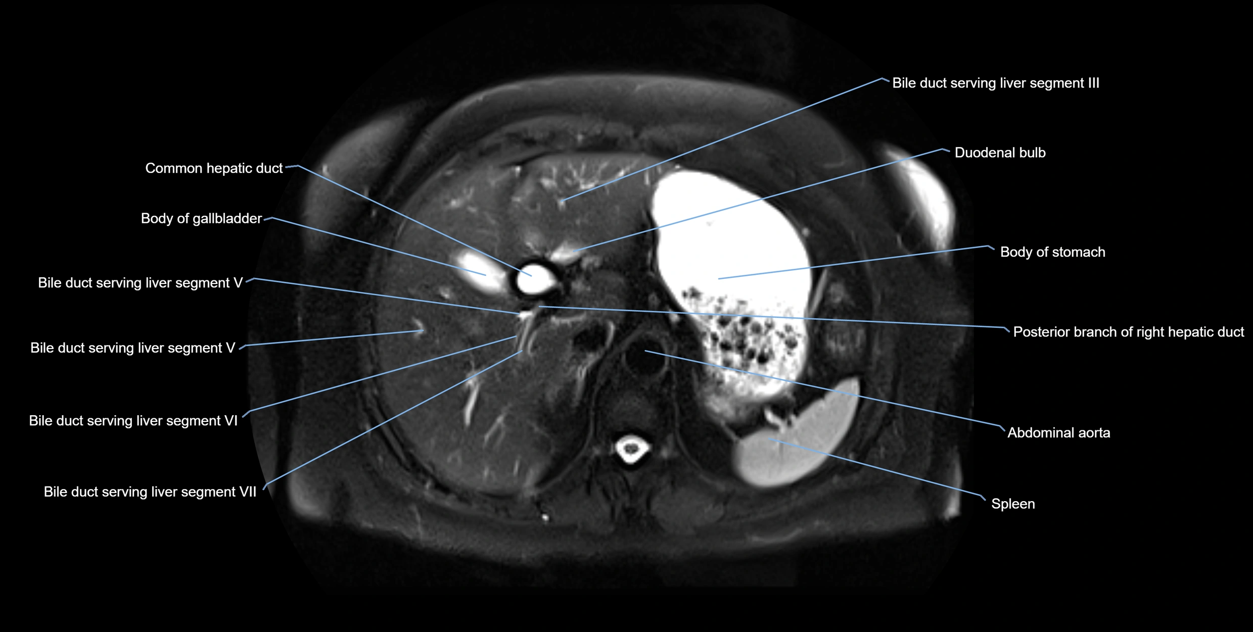 MRI MRCP axial cross sectional anatomy 3T radiology  image-img-10001-00016.webp